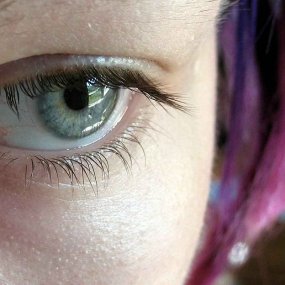 scleral lenses for dry eye