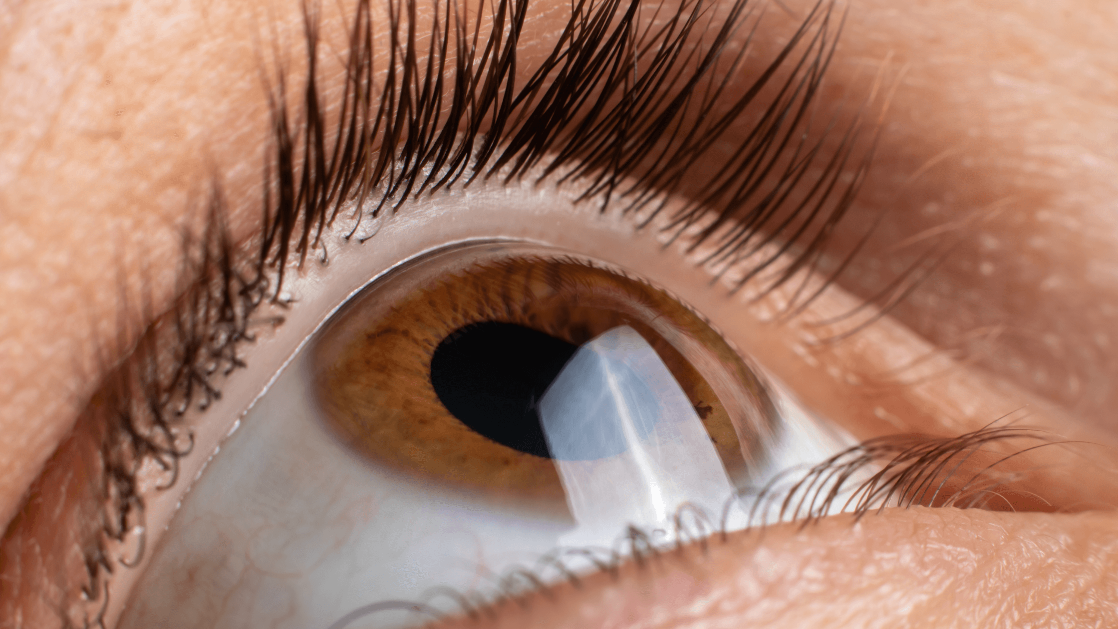 If you’ve been diagnosed with myopia, hyperopia, astigmatism or presbyopia, you may be an ideal candidate for Orthokeratology contact lenses