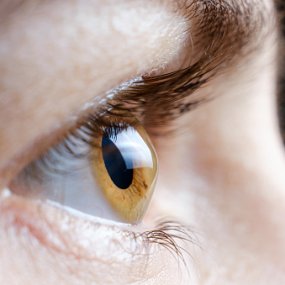What is it Like to Have Keratoconus?